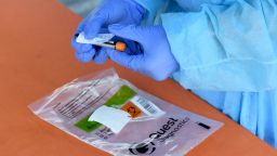 BURBANK, CALIFORNIA - AUGUST 24:  Mend Urgent Care workers wearing personal protective equipment perform drive-up COVID-19 testing for students and faculty on the first day of school at Woodbury University on August 24, 2020 in Burbank, California. Most California schools are have gone virtual while others are placing physical distancing and other protocols like testing to keep in-person classes in session.  (Photo by Kevin Winter/Getty Images)